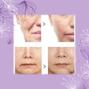 Soin visage raffermissant expertlift